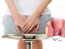 Cách nhận biết bệnh trĩ nội