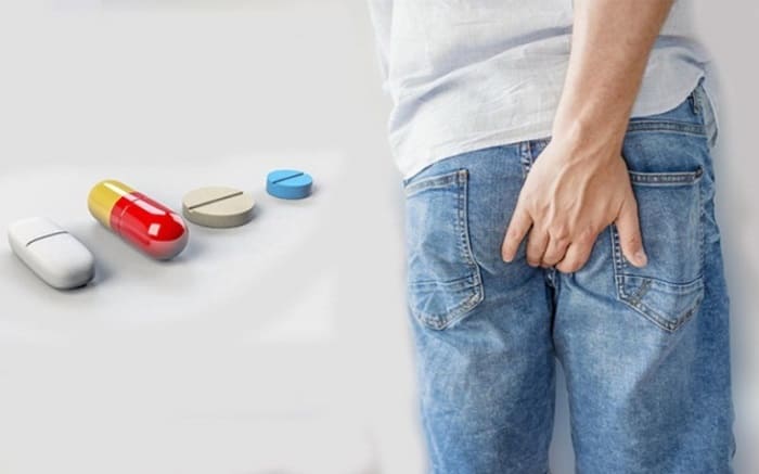 Giảm đau búi trĩ bằng thuốc
