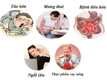 Nguyên nhân chính gây ra bệnh trĩ ngoại