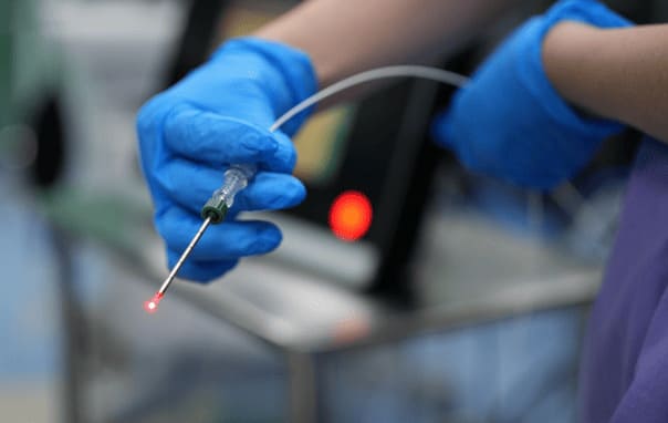 Loại bỏ bệnh trĩ bằng kỹ thuật laser