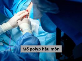 Mổ polyp hậu môn