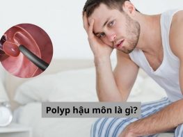 Polyp hậu môn là gì?