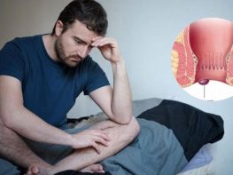 Trĩ ngoại có tự hết không
