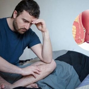Trĩ ngoại có tự hết không
