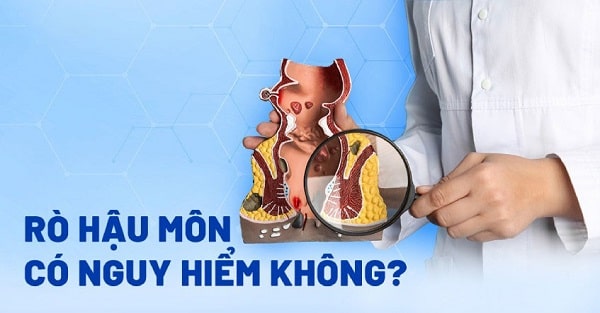 Thực hư bệnh rò hậu môn có nguy hiểm hay không?