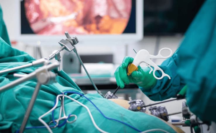 Cập nhật nhanh quá trình thực hiện cắt polyp hậu môn