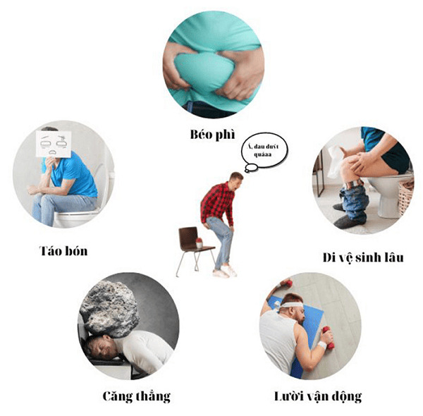 Đâu là nguyên nhân gây ra trĩ ngoại?