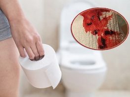Nhận biết hiện tượng đại tiện ra máu như thế nào ?