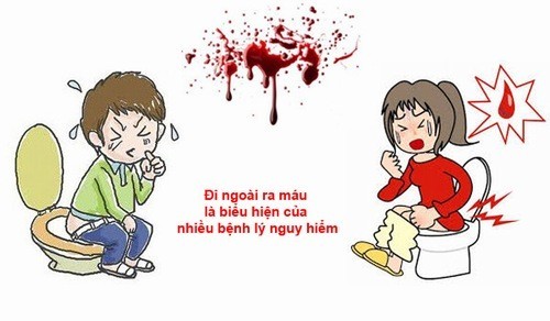 Hiểu đúng về triệu chứng đại tiện ra máu để dự đoán nguyên nhân