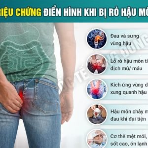 Đâu là dấu hiệu rò hậu môn tái phát?