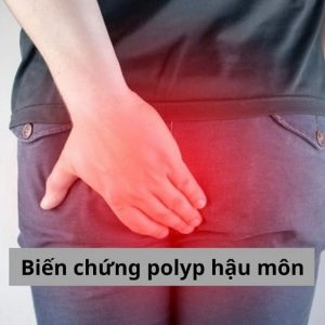 Biến chứng polyp hậu môn