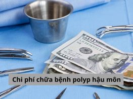Chi phí chữa bệnh polyp hậu môn