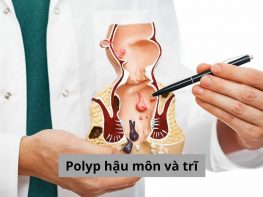 Polyp hậu môn và trĩ