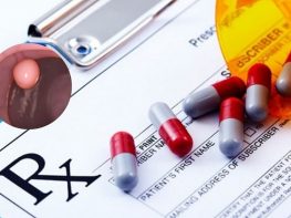 Thuốc trị polyp hậu môn