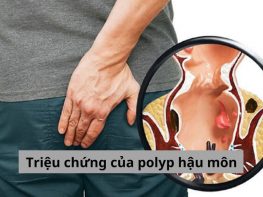 Triệu chứng của polyp hậu môn
