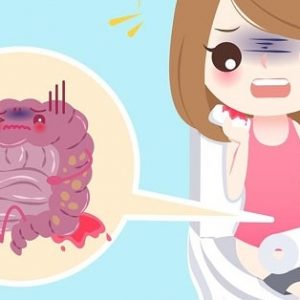 Bị táo bón đi đại tiện ra máu có nguy hiểm không?
