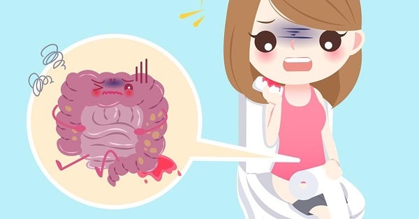 Bị táo bón đi đại tiện ra máu có nguy hiểm không?
