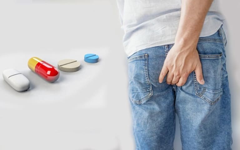 Cách làm co búi trĩ nội hiệu quả bằng phương pháp nội khoa
