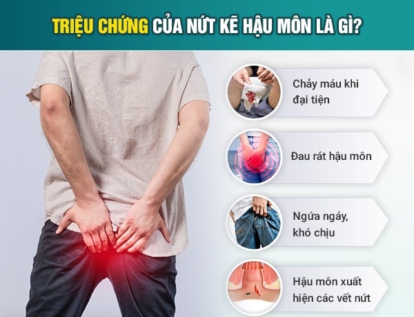 Triệu chứng thường gặp ở người bị nứt kẽ hậu môn