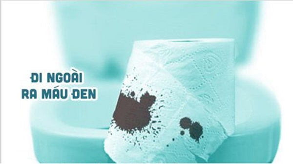Lưu ý các dấu hiệu đi kèm với đại tiện ra máu đen