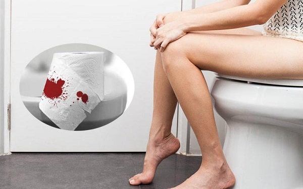 Nguyên nhân đại tiện ra máu tươi liệu bạn đã nắm rõ?