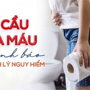 Đi đại tiện ra máu có nguy hiểm gì không?