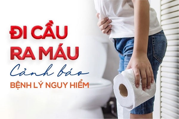 Đi đại tiện ra máu có nguy hiểm gì không?