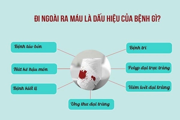 Nguyên nhân dẫn đến đi đại tiện ra máu là bệnh gì ?