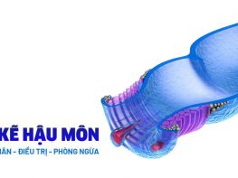 Tìm hiểu 1 số thông tin chung về bệnh nứt kẽ hậu môn