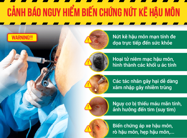 Nứt kẽ hậu môn để lâu sẽ nghiêm trọng như thế nào?