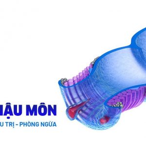 Tìm hiểu 1 số thông tin chung về bệnh nứt kẽ hậu môn