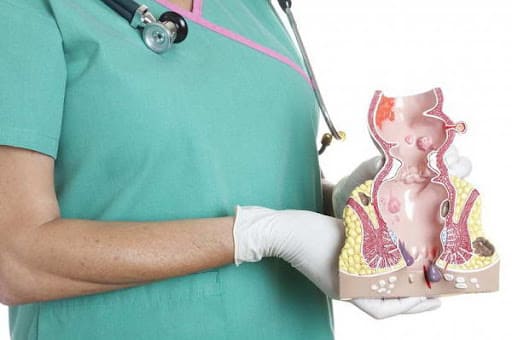 Polyp hậu môn và trĩ liệu có thể tự khỏi hay không?