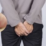 Áp xe hậu môn có nguy hiểm không