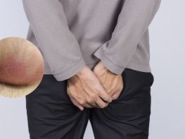 Áp xe hậu môn có nguy hiểm không