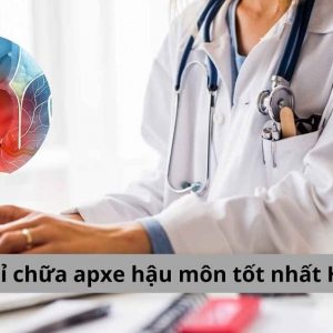 Địa chỉ chữa apxe hậu môn tốt nhất Hà Nội