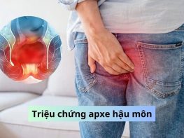 Triệu chứng apxe hậu môn