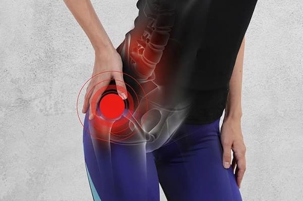 Đau nhức âm ỉ rồi chuyển thành đau buốt, lan rộng vùng mông
