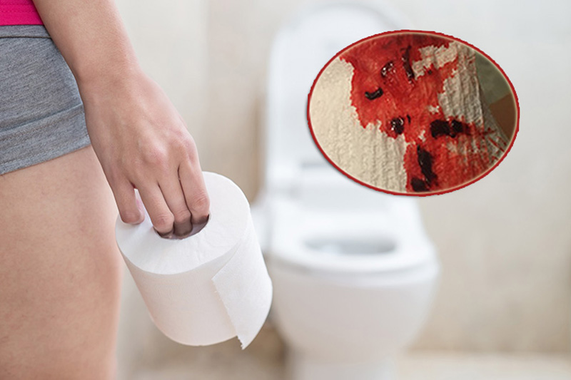 Vì sao bà bầu đi đại tiện ra máu tươi ? Lý giải nguyên nhân