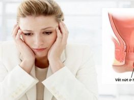 Vì sao thời điểm chữa nứt kẽ hậu môn lại quan trọng ?