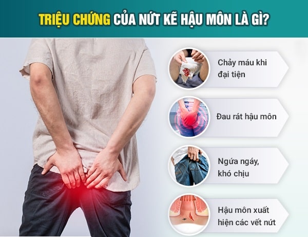 Nứt kẽ hậu môn và những biểu hiện thường gặp
