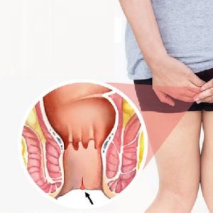 Vì sao nên cân nhắc thật kỹ trước khi lựa chọn địa chỉ chữa nứt kẽ hậu môn?