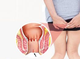 Nứt kẽ hậu môn có nguy hiểm gì không ?