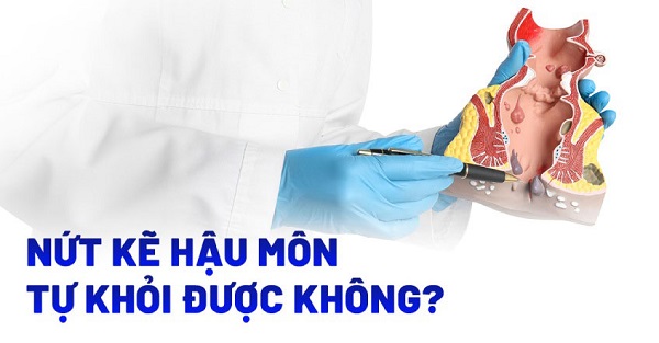 Nứt kẽ hậu môn có tự khỏi được không ?