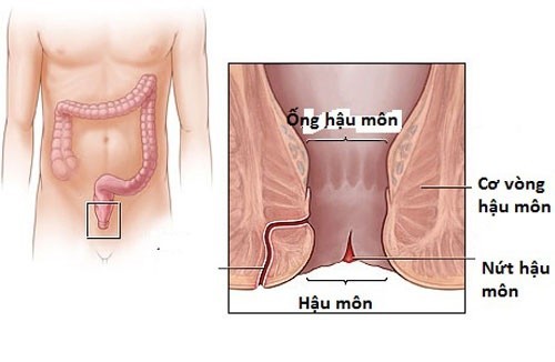 Nứt kẽ hậu môn là bệnh gì và ảnh hưởng như thế nào đến sức khỏe?