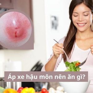 Áp xe hậu môn nên ăn gì?