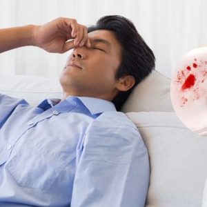 Cắt trĩ xong đi ngoài ra máu