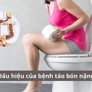 Dấu hiệu của bệnh táo bón nặng