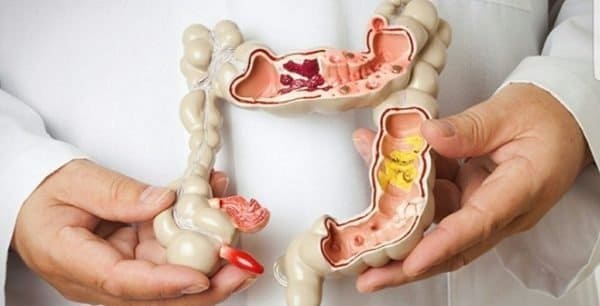 Hậu quả nếu không điều trị táo bón