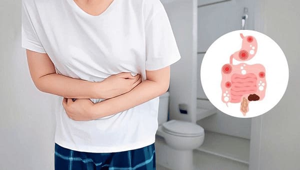 Bệnh táo bón nặng xảy ra nguyên nhân do đâu?