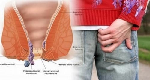 Ngứa hậu môn do nguyên nhân sinh lý